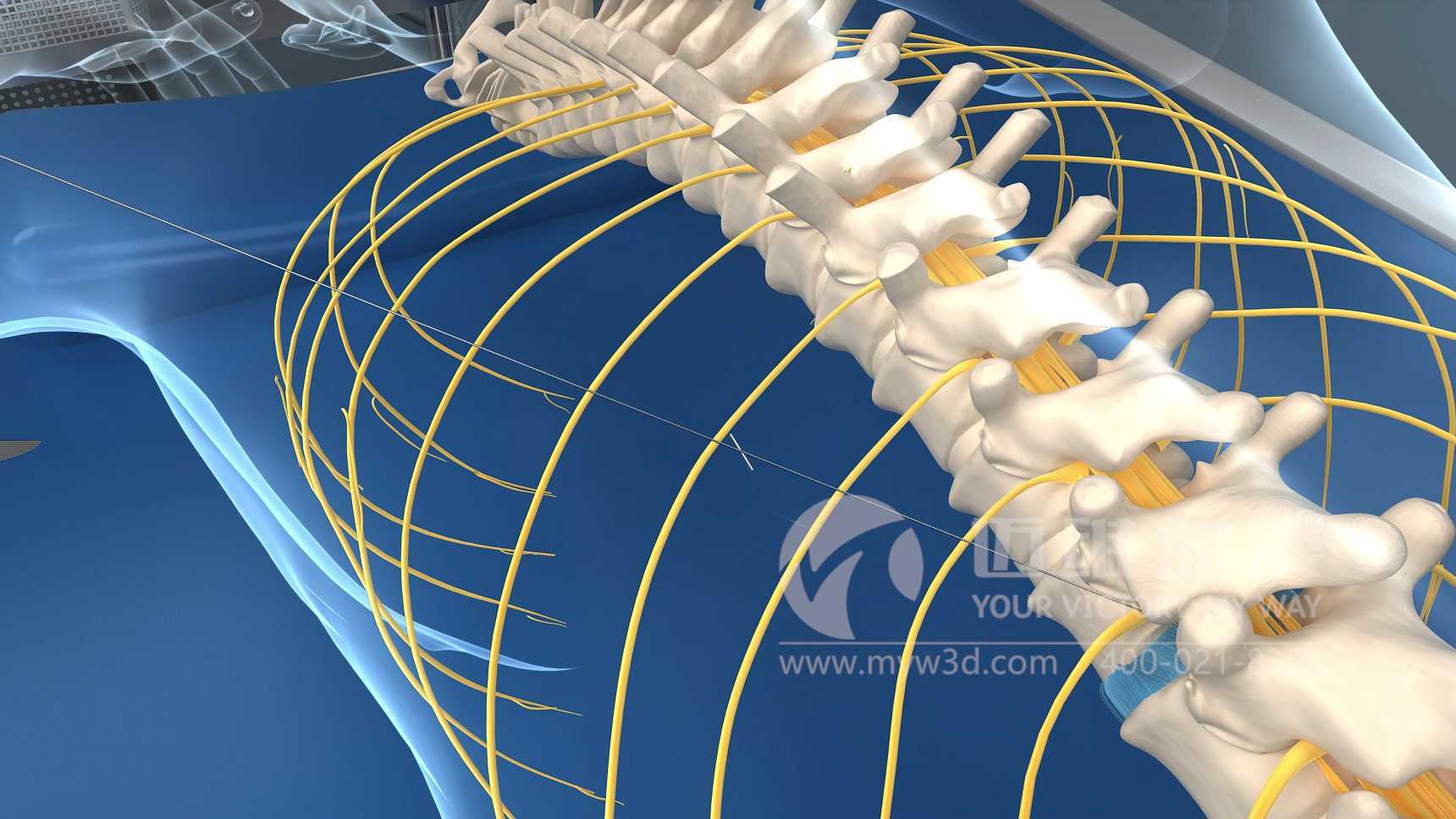 外科手术过程腰椎手术动画演示短片-工业三维动画制作公司