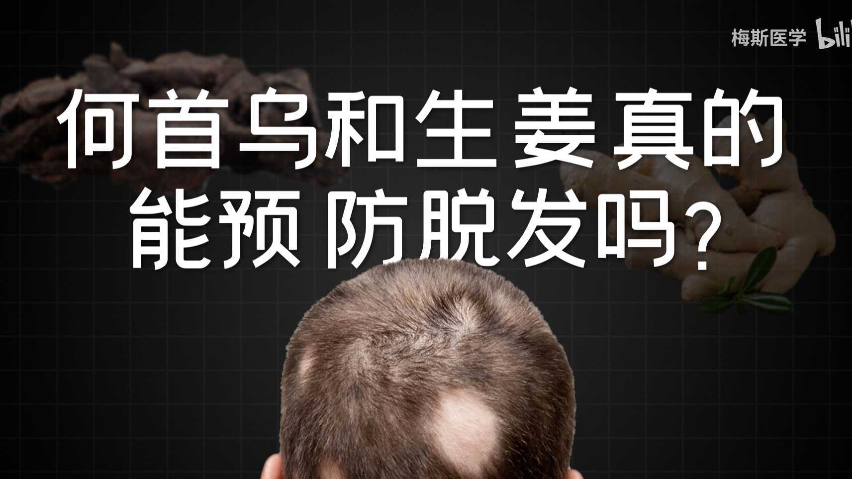何首乌和生姜真的能预防脱发吗？