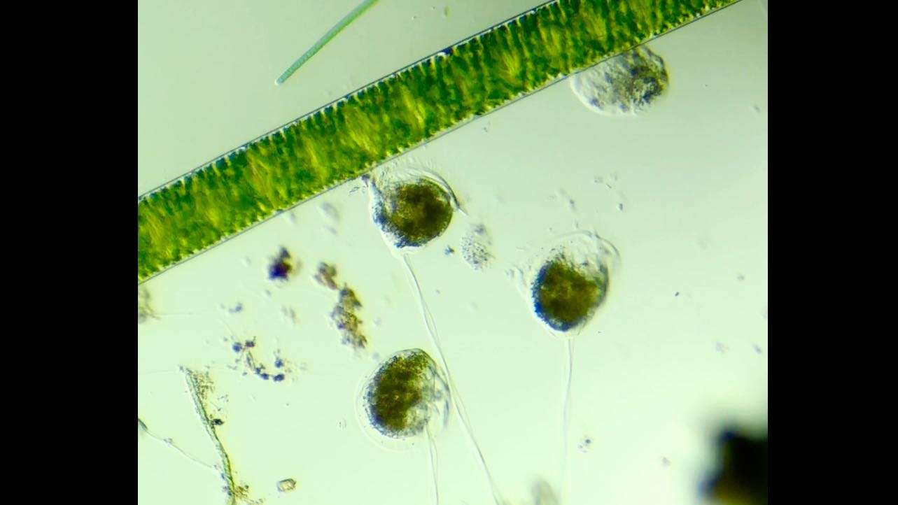 显微镜下的真实微生物，漂亮得像一幅动态水墨画