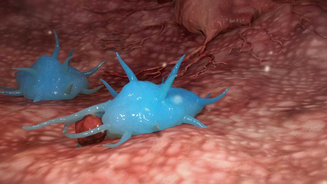 【3D医学动画】PanTum肿瘤检测动画