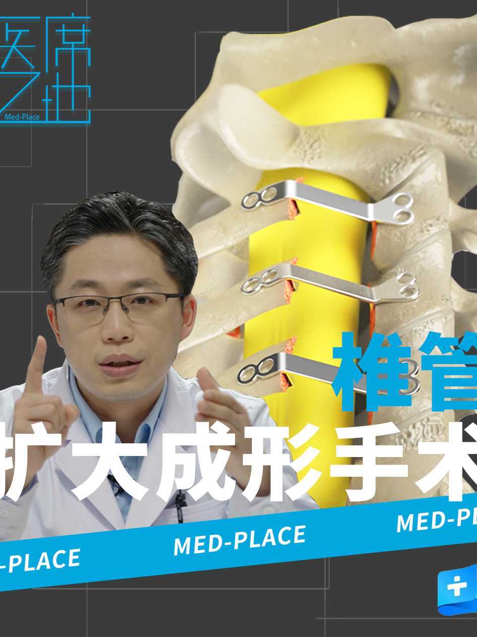 【医席之地】颈椎病之殇 椎管扩大成形手术