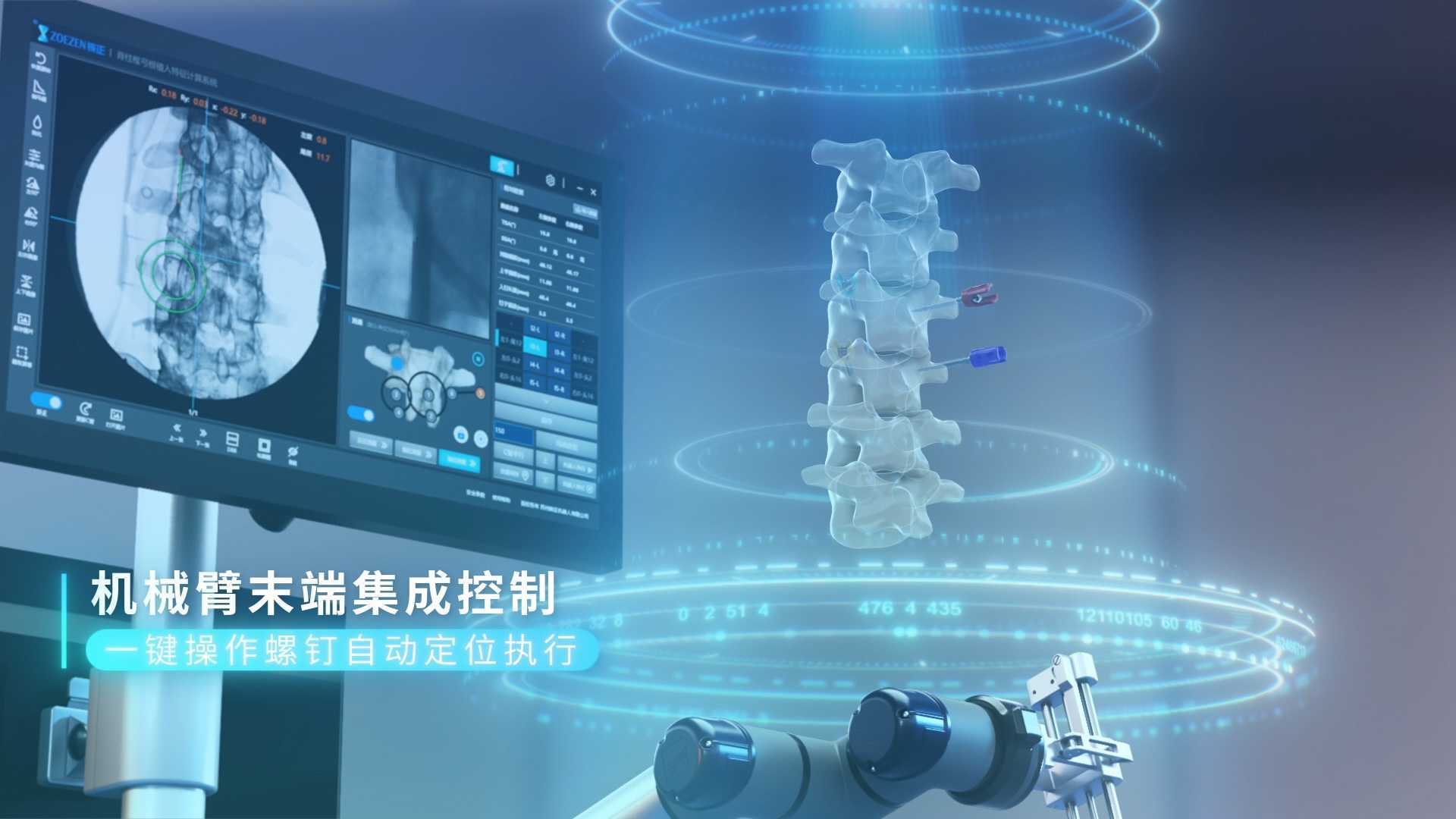 佐航300机器人-脊柱外科手术导航定位设备
