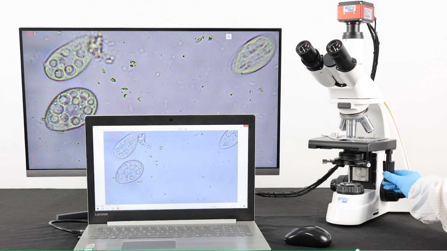 生物显微镜看细菌细胞